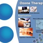 نحوه تجویز ازن